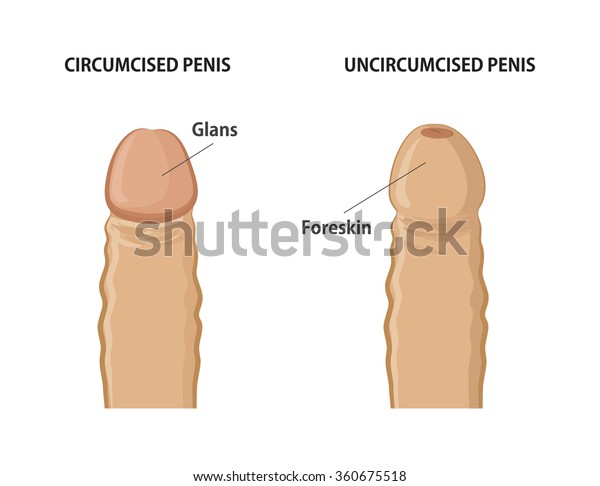 barbara householder reccomend uncircumcised penis photo pic
