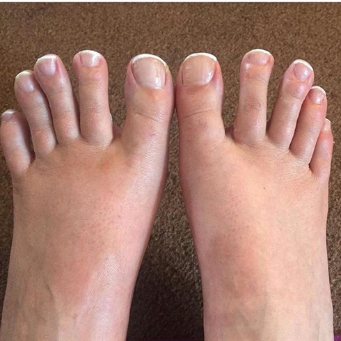 French Nails On Toes pear cumception