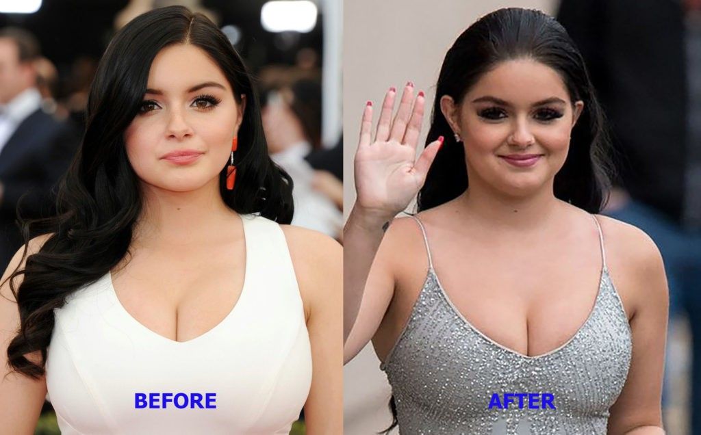 ariel winter fake boobs