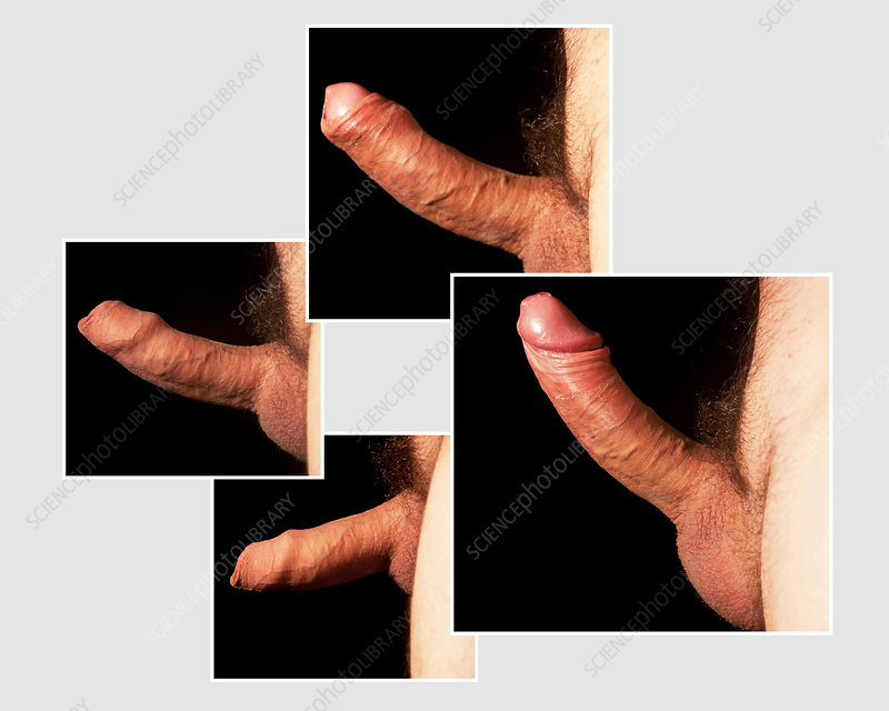 dana speer share uncircumcised penis photo photos