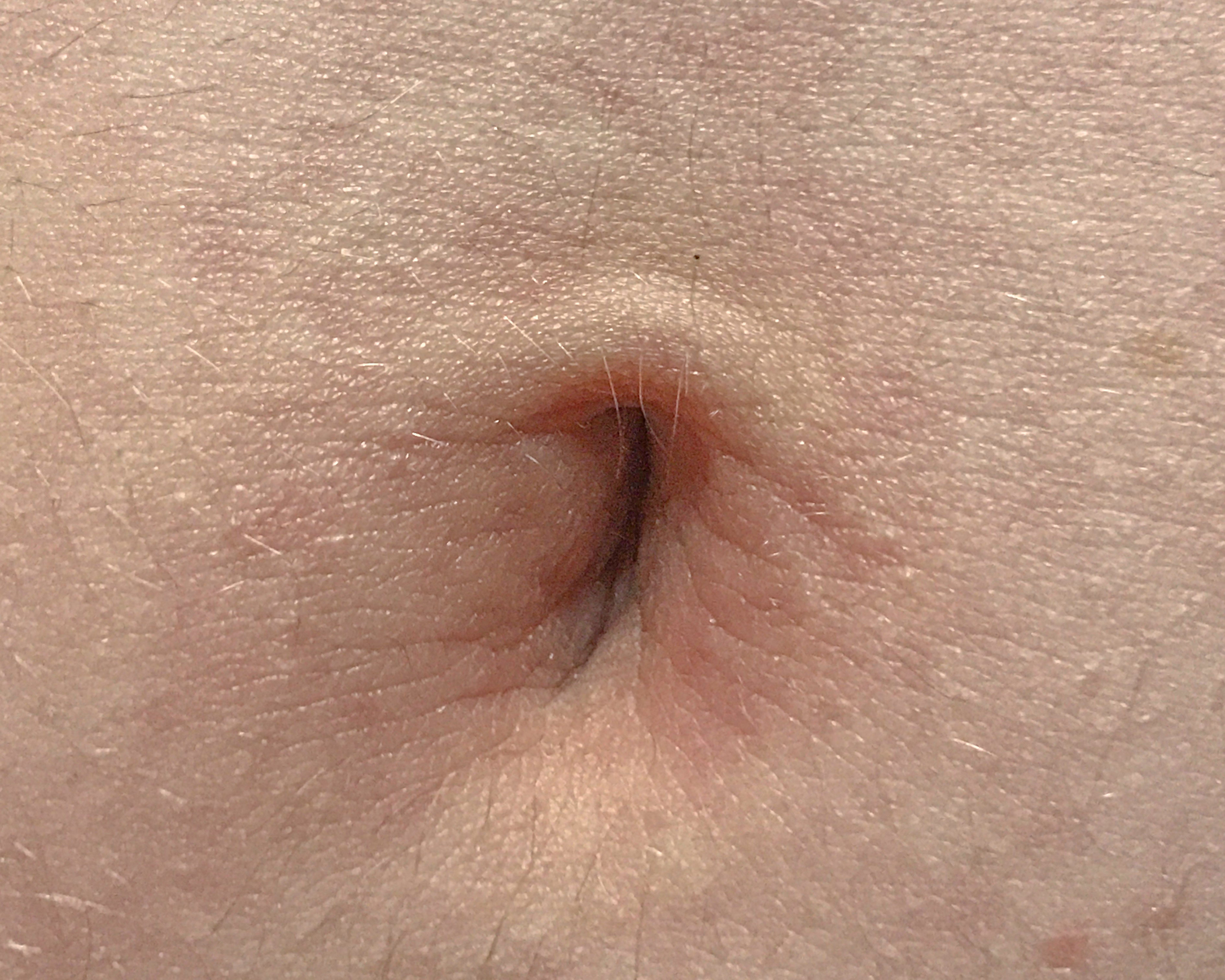 adela alba reccomend biggest outie belly button pic