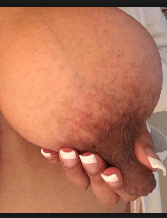 alex vinsant share tumblr big long nipples photos