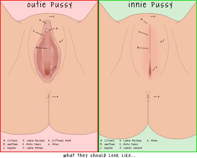 catherine dean reccomend what is an outie vagina pic