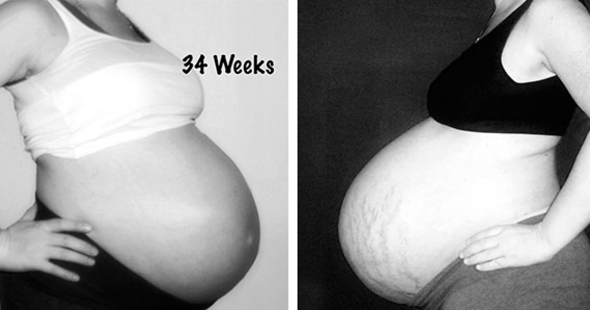 clinton benard share huge twin pregnant belly photos