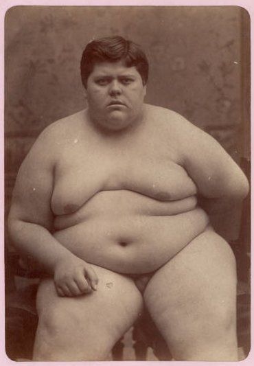 ali alian reccomend Pictures Of Fat People Naked